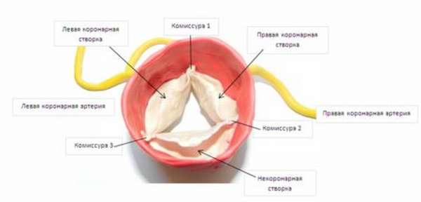 Причины развития аортального стеноза и степень тяжести патологического процесса