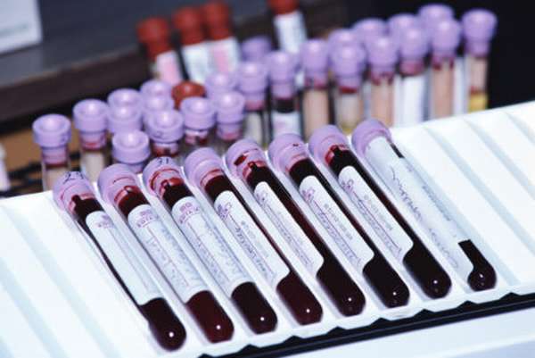 Особенности определения гемоглобина в крови, основные методы диагностики и лечения патологических состояний