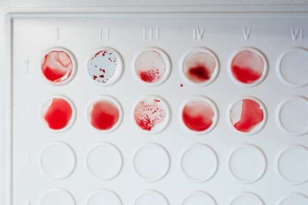 Как определяют группы крови с помощью цоликлонов, и насколько это достоверно?
