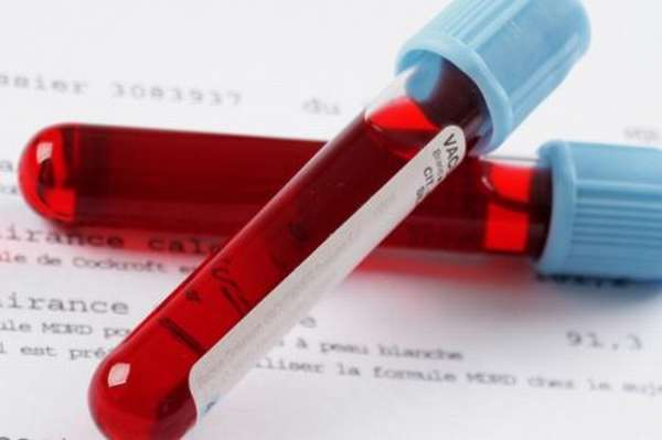 Как выполняется расшифровка результатов биохимического анализа крови у взрослых? Нормы в таблице