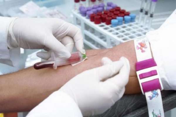 Зачем назначают сдачу анализа крови на ЛДГ, и что показывает исследование?