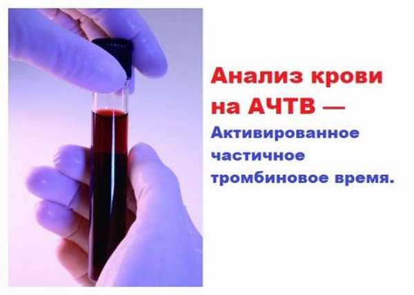Расшифровка : что такое АЧТВ в анализе крови, зачем проводят исследование