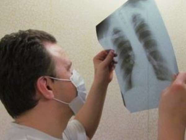 Диагностируют туберкулёз только доктора