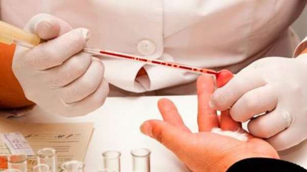 Можно ли сдавать анализ крови во время месячных? Когда это строго запрещено?