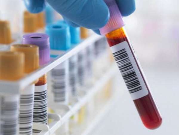 Что означают анализы крови на маркер HE4 и для чего его проводят женщинам?