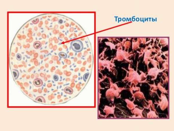 Насколько опасны пониженные тромбоциты в организме человека?