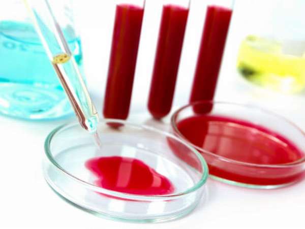 Сколько дней делается анализ биохимического состава крови, и для чего он нужен?