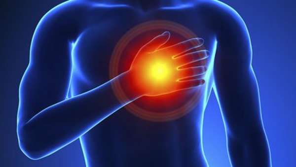 Можно ли ставить горчичники на сердце при приступах стенокардии?